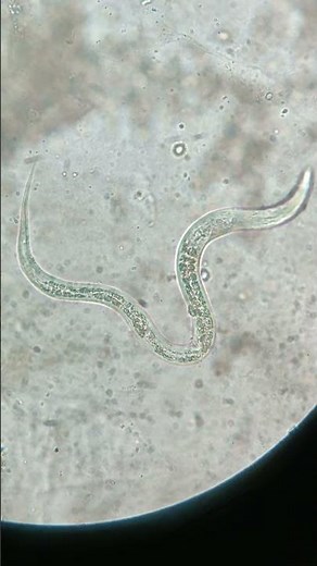 C. elegans under microscope #biology #science #worms
