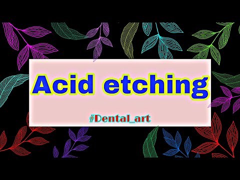 Acid etching in dentistry