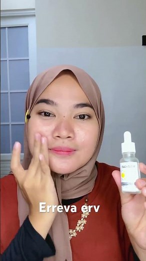 Whitelab niacinamide 10 % | Serum doktif approved | Rekomendasi serum mencerahkan wajah