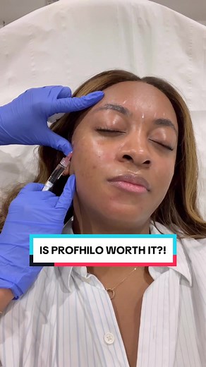 Profhilo Treatment Review: Worth It? Before & After Results