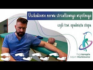 Uszkodzenie nerwu strzałkowego wspólnego