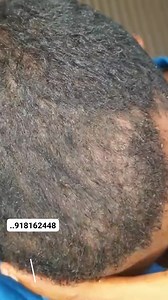 3.9K views · 36 reactions | ☎️0986848148 #feghairgrowspraybenefits #hairoilsforgrowthl #hairtnansformation #minoxdel #HairGoals2025 #hairoilsforgrowth #hairgol #habeshabeauty #hairgoals #hairtransformation | እናት ኮስሞ | Facebook