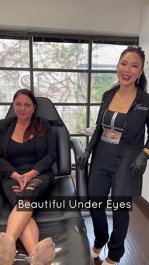 Beautiful under eyes 💉 Using stem cells and smooth threads to decrease the appearance of dark under eye circles 🤗 Let us know what you think down below ⬇️ #fyp #undereye #undereyecircles #stemcells #darkcircles