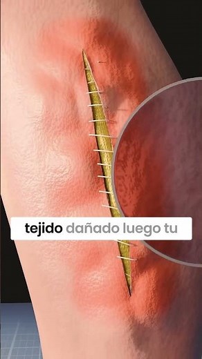 ¡Mira cómo tu cuerpo repara heridas con puntos!