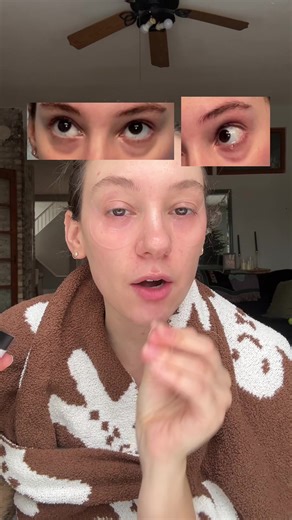 Effective Eye Patches for Dark Circles and Puffiness