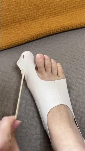 Professional Bunion Corrector Splint 👣 | Adjustable Big Toe Alignment Support 💙