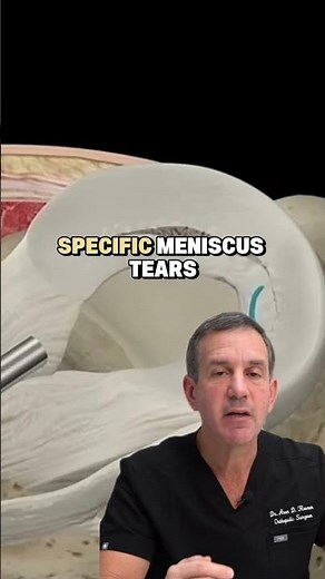 Faster meniscus recovery technique