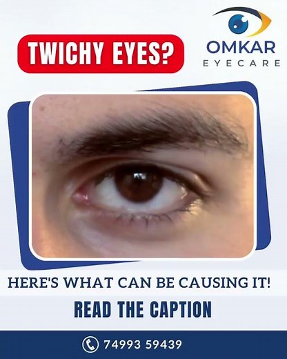 Eye Twitching Explained! 😳 Causes, Relief & When to See a Doctor | Omkar Eye Hospital