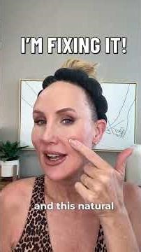 I’m fixing my cheeks with threads and filler! #antiaging