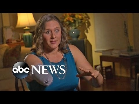 Florida Alligator Attack Victim Recalls Battle for Her Life