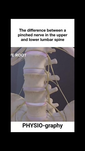 113K views · 807 reactions | Sciatica explained | PHYSIO-graphy | Facebook