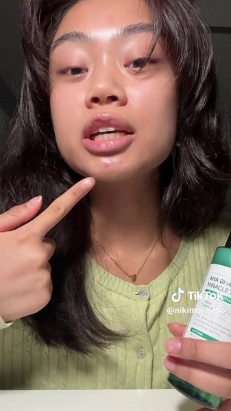 Some By Mi AHA BHA PHA Miracle Toner Review: Clearing Cystic Acne!