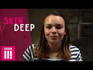 Being Confident With Facial Scarring | Phyllida | Skin Deep