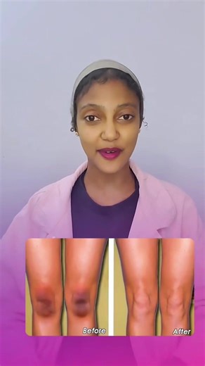 Tumeric: Health Benefits and How to Use it