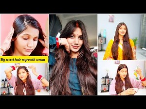 Extreme hair regrowth stop hair fall / onion juice hair growth before and after