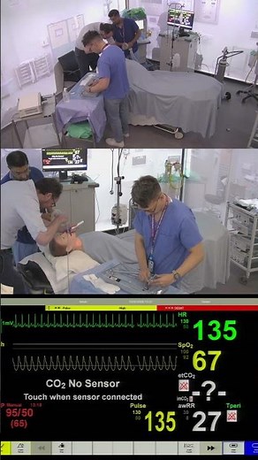 Paediatric Foreign Body Removal – Airway Simulation Using Rigid Bronchoscope
