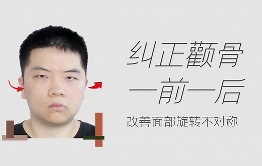 颧骨一前一后？嘴角下垂？高低眼？3个动作改善上镜大小脸！纠正面部旋转不对称