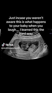 POV: Your baby during your laughing fit in the ultrasound room Poor baby just living through mini earthquakes every time you laugh! 😂 Pregnancy really is a wild ride for both of you. 🎥: destiniesanchez51 #theAsianparent #PregnancyHumour #MumLife #PregnantInSingapore #ParentingSG #BabyBump #PregnancyJourney | theAsianparent