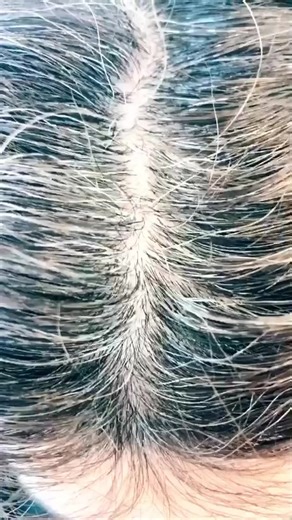 Stunning 5N Light Chestnut Brown Transformation