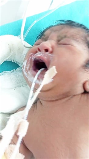 NICU Protocol: Handling Preterm Babies 👶🩺 #baby #neonatalcare #cutebaby #nicu #physiotherapy