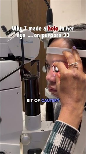 It looks like I’m burning a hole in her eye… …but this is exactly how we fix the problem 👀 🧠 Why