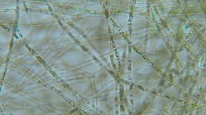 Green Algae Water Plant Under Microscope Stock Footage Video (100% Royalty-free) 3583354929 | Shutterstock