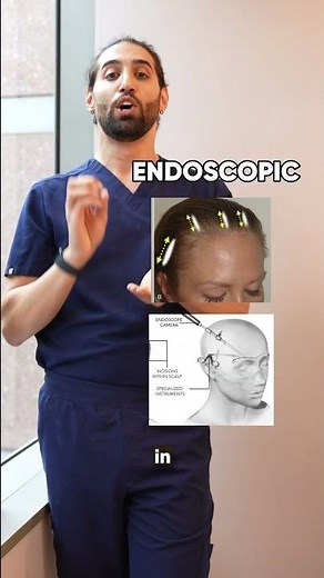 Temporal vs. Endoscopic Brow Lift — which one’s better?