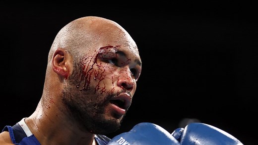 JO 2021 (boxe): blessé après sa victoire sur Aliev, Clarke arrêté lors de sa demi-finale