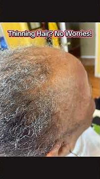 PERFECT Braid Pattern For Those with Thinning Hair & Thin Edges #braidpattern #thinhair #thinedges