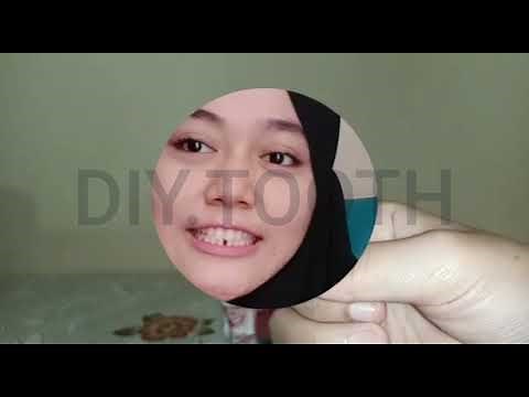 Cara menggunakan gigi palsu sementara - DIY.TOOTH review. Cara menggunakan temptooth