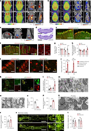 Powering brain health: How autophagy protects neurons by controlling their glucose consumption