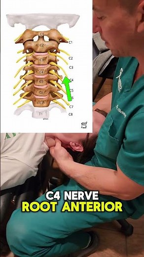 C4 nerve stuck in neck causing shoulder pain