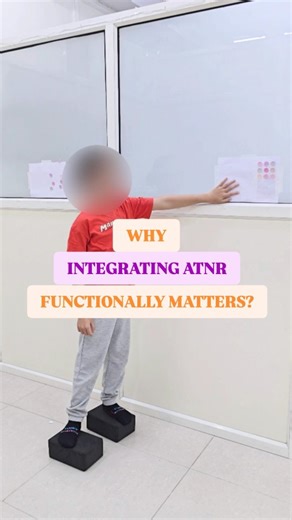 CONNECTING DOTS | CHILD DEVELOPMENT CENTER on Instagram: "⚙️ Functional Benefits of ATNR Integration • 🖐️ BETTER BILATERAL COORDINATION → Both sides of the body start working together efficiently. (E.g., catching a ball, dressing, cutting with scissors) • ✍️ IMPROVED HANDWRITING & DESK WORK → The child can turn their head or look across the page without the writing arm automatically moving. • 👁️ ENHANCED VISUAL TRACKING & READING SKILLS → Smooth eye movements across midline for fluent reading 