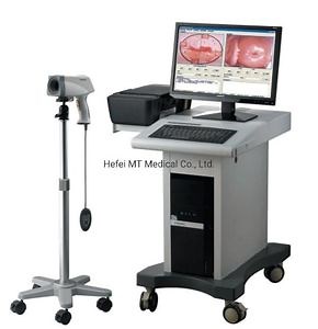 [Hot Item] Mt Medical CE Approved Optical Portable Vagina Colposcope for Gynecology Colposcopy Camera Mobile Trolley