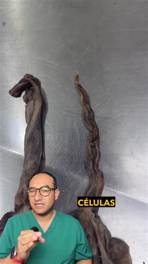 Dr. Giovanni Galindo | Médico Forense on Instagram: "Lo que ves aquí no es morbo: es anatomía sin filtros. Testículo y cordón espermático: una estructura perfecta, frágil y más compleja de lo que la mayoría imagina. La biología humana no siempre es bonita… pero siempre es impresionante. 🔴 Escribe VIDA si llegaste hasta el final. 🎓 @dr.giogalindo | Anatomía real, sin censura. #AnatomíaHumana #EducaciónAnatómica #CordónEspermático #ReelsAcadémico #CienciaReal #AnatomíaSinFiltros #drgiogalindo #c