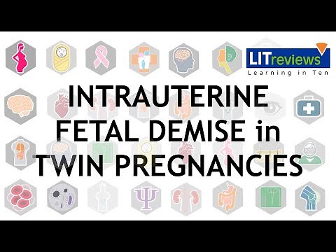Impact of Chorionicity on Risk and Timing of Intrauterine Fetal Demise in Twin Pregnancies