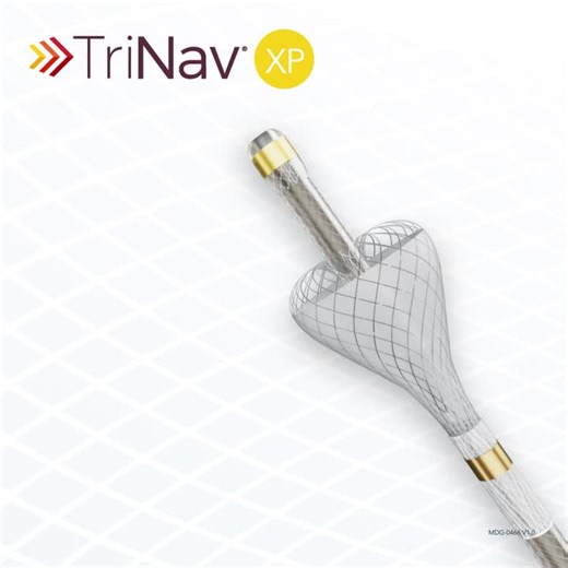 TriNav® XP is compatible with larger particles and engineered for more tortuous anatomy