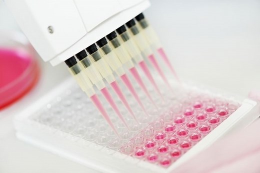 Exame HCV: o que é, para que serve e como é feito