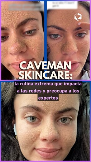 Caveman Skincare: la rutina extrema que impacta a las redes y preocupa a los expertos. #Skincare #beauty #rutinafacial #viralreels | Cultura Colectiva Lifestyle