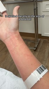 Throughout my life, I’ve been stung by all kinds of bugs—bees, wasps, you name it—and never once had anything more than a little pain and swelling. But two days ago, everything changed. While playing with my dogs, one of them stepped into a yellow jacket nest. They swarmed, chasing him—straight to me. Before I could react, I was stung multiple times. I ran to the four-wheeler where @thegoldenpup.co was waiting, but not before she got stung too. We sped out of there as fast as we could. The dogs 