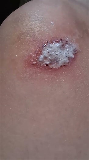 why you should not put max speed on a treadmill