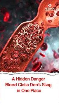 A Hidden Danger: Blood Clots Don't Stay in One Place - Dr. Manisha Joshi