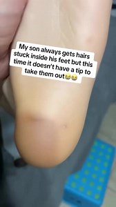 4.3K views | Let's Clean Up 2025  (8) | Pimple Popper | Facebook