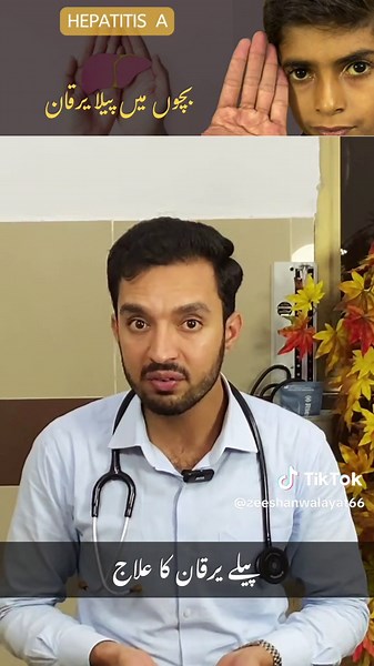 Treatment of Acute Viral Hepatitis: Understanding Hepatitis A and Peela Yarqan