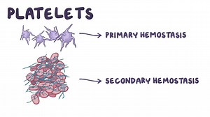 Video: Thrombocytopenia: Clinical - Video Explanation! | Osmosis | Osmosis