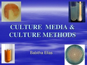 CULTURE MEDIA &amp; CULTURE METHODS - SlideServe