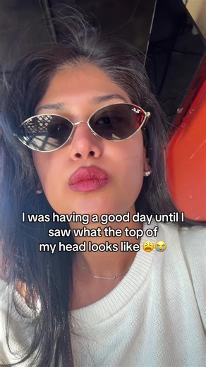 Top Hair Loss Solutions for 2026: Care and Recovery Tips