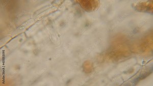 Chloroplast Under a Microscope Dead Plant. Cell Division. Dead Plant Cell Structure. Virus Infection. Microbes Microorganisms Bacteria Under Microscope. GMO DNA.