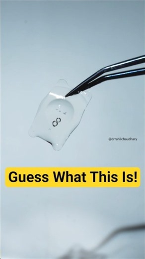 The Tiny Lens That Fixes High Eye Power!!