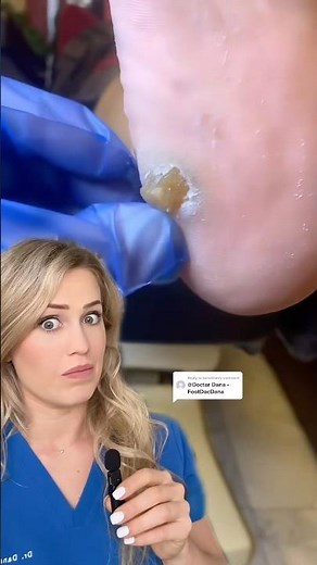 Doctor reacts to a satisfying removal